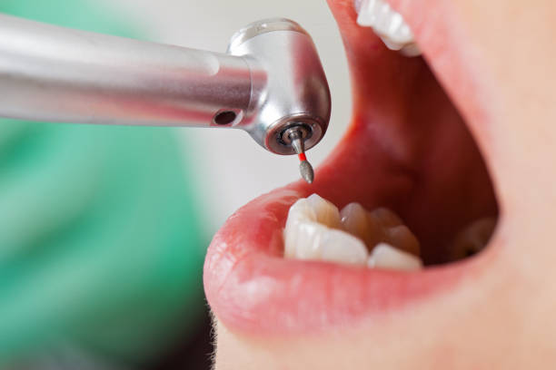 Emergency Gum Pain Relief in AZ